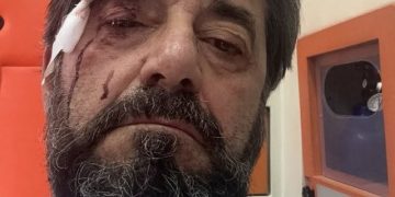 Dh*unohet gazetari Ilir Demalia